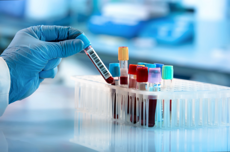 Aspire offers laboratory services such as blood testing as shown.